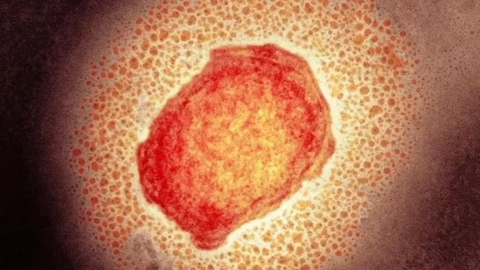 VARIOLA