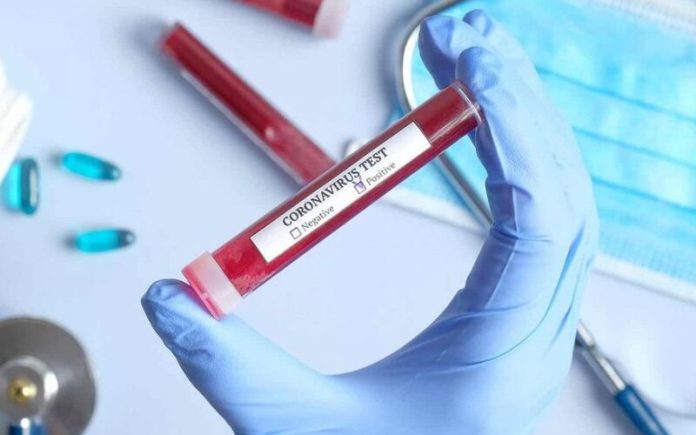 coronavirus-test-800x500
